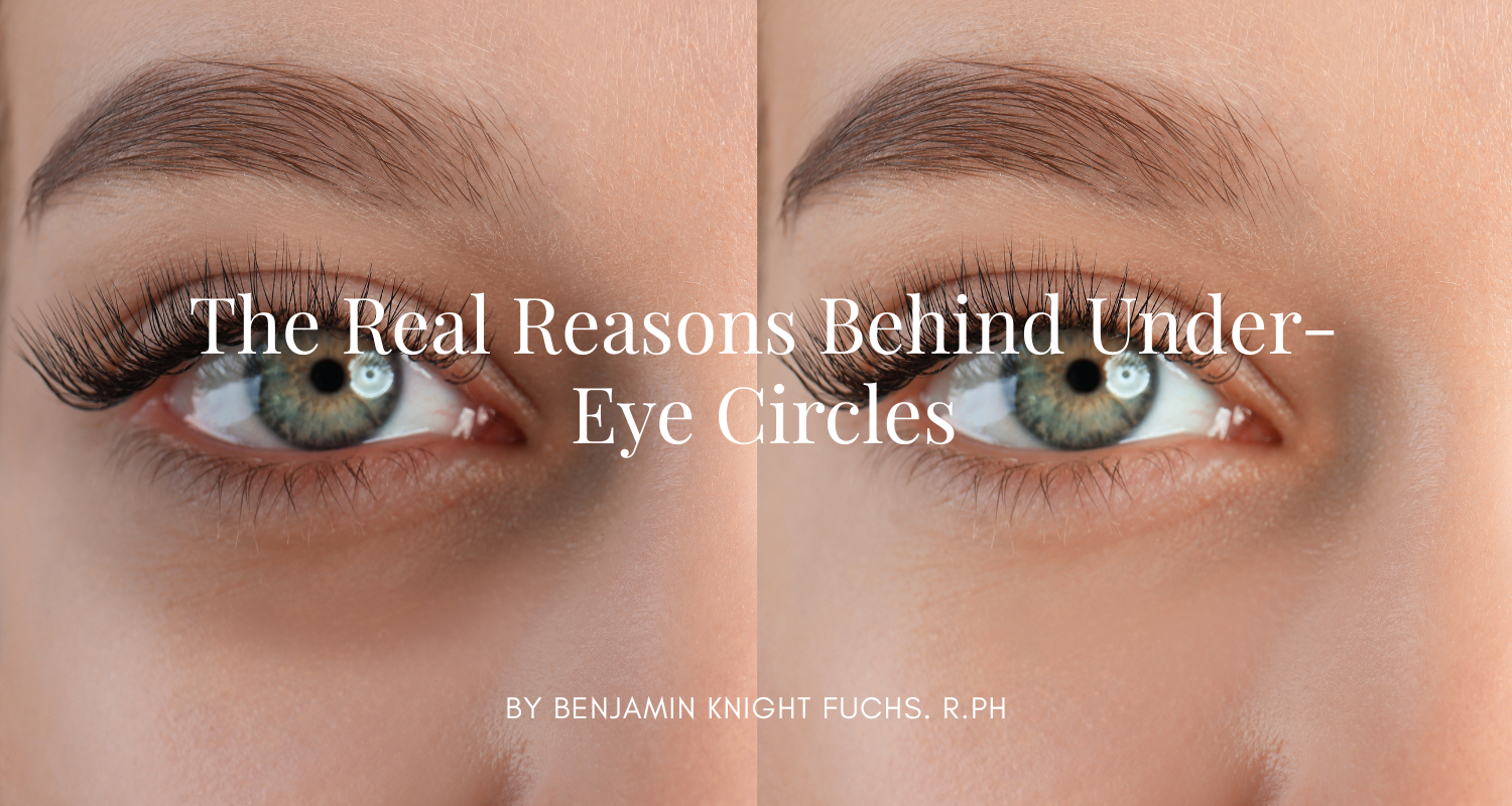 Why You Have Dark Circles—and What You Can Do About It